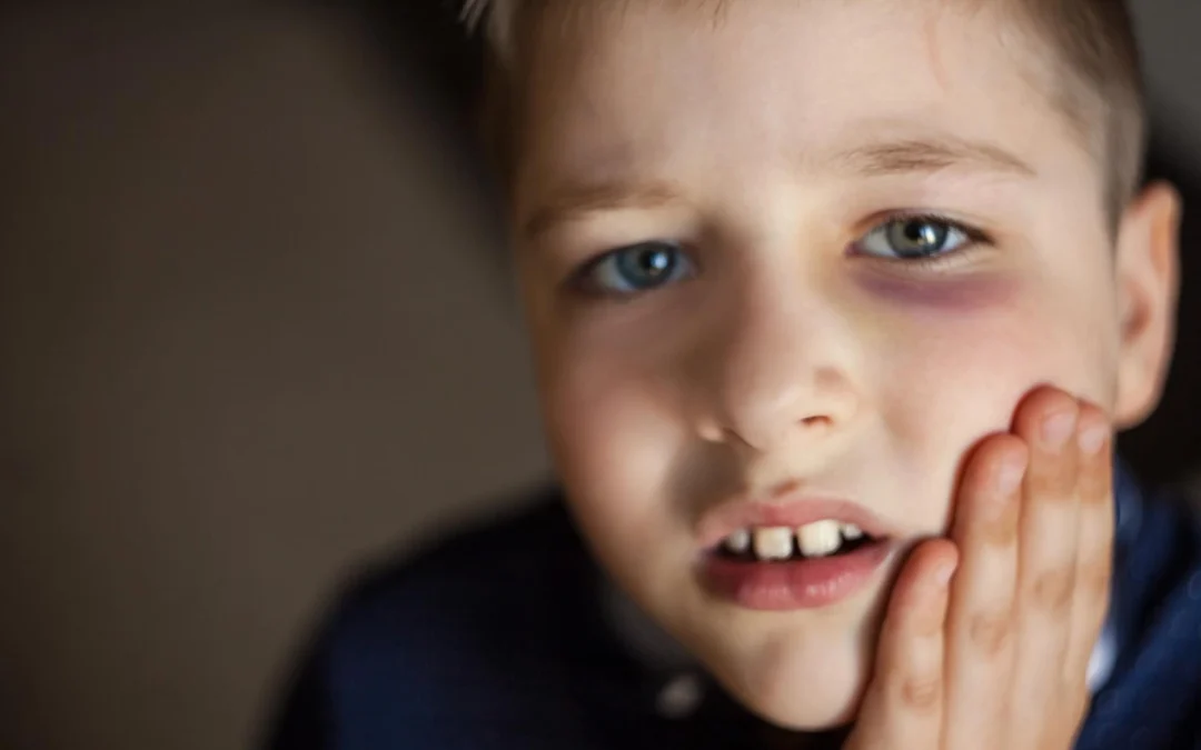 Carie ai denti dei bambini a Ozieri: ecco cosa fare